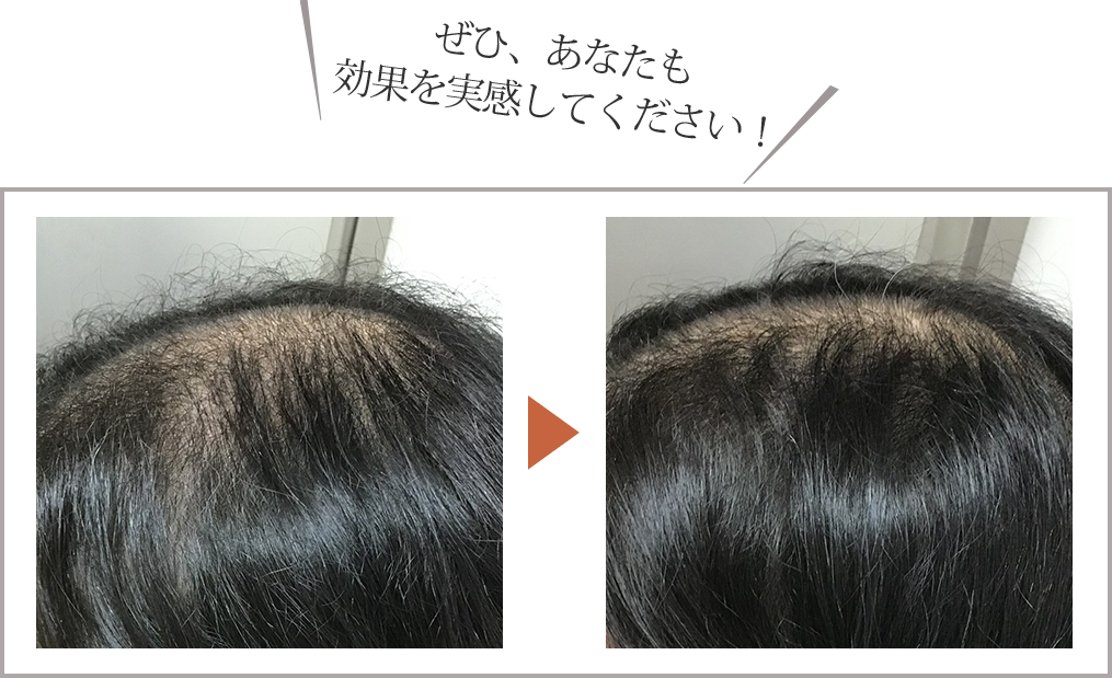 施術前と施術後の比較