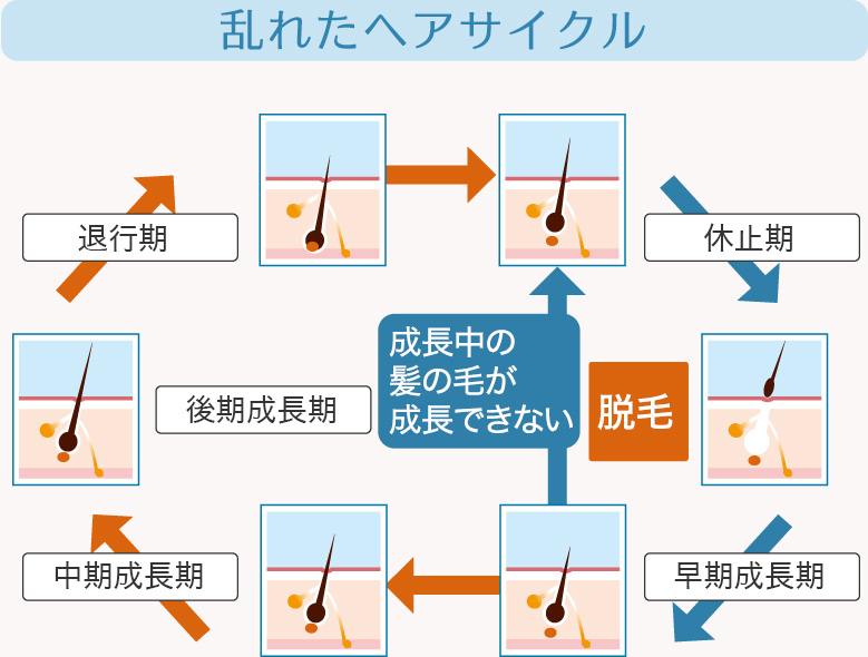 乱れたヘアサイクル